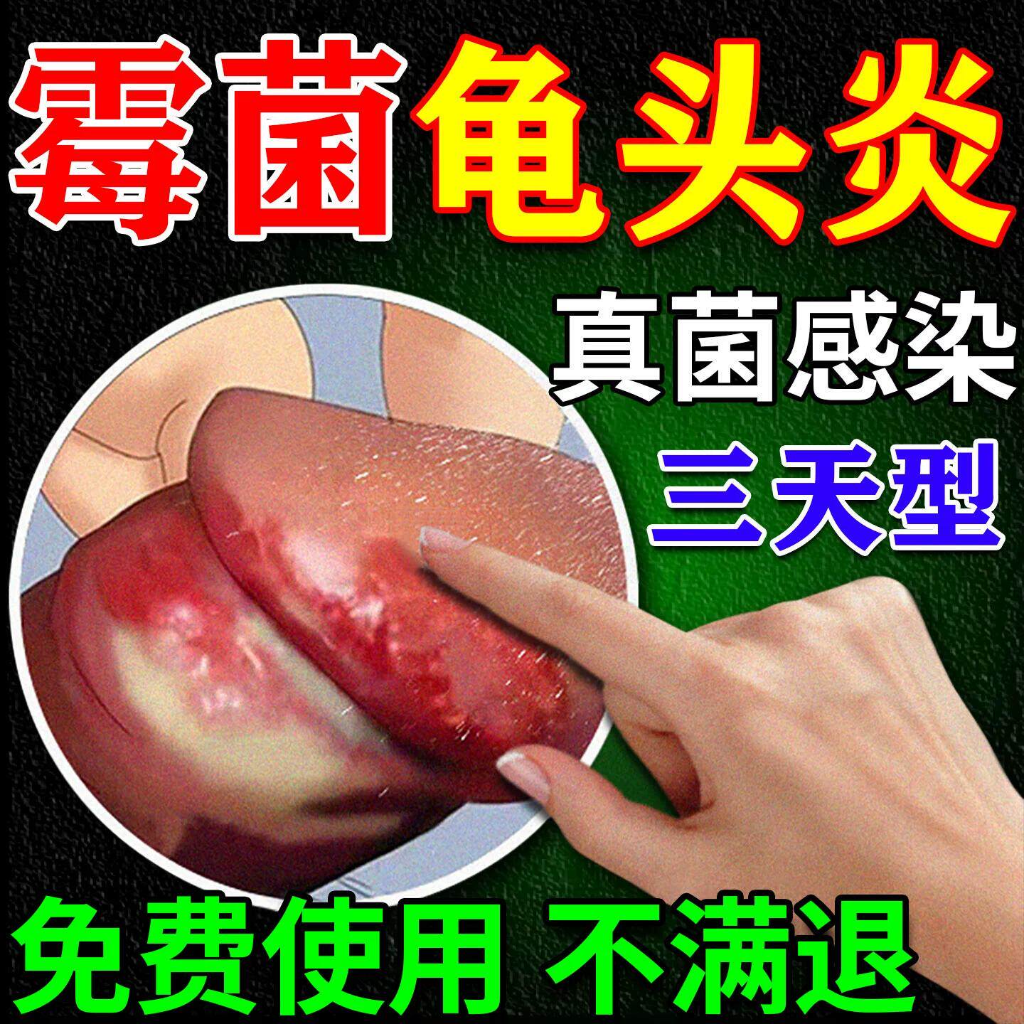 包皮男龟头炎症专用包皮发炎特效珍珠粒疹去除真菌感染夭瘙痒喷剂