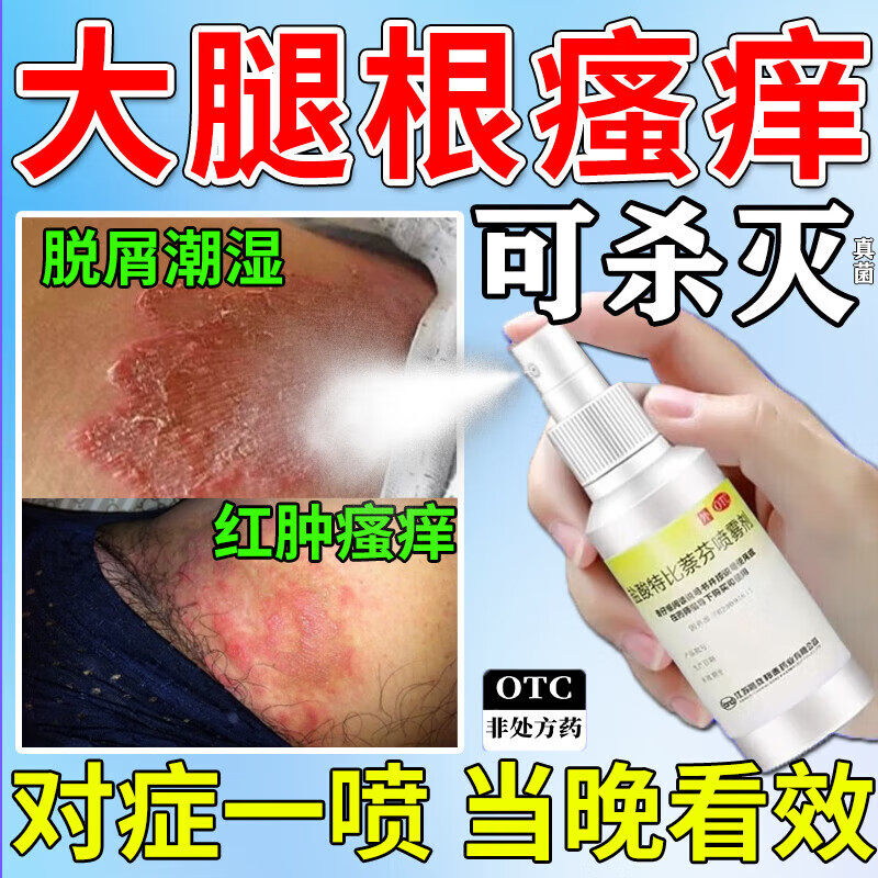 【齐鲁】盐酸特比萘芬喷雾剂1%*15ml*1瓶/盒