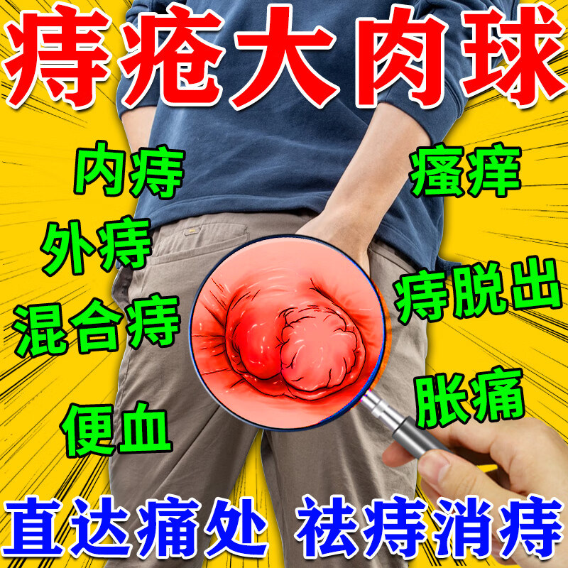 痔疮药膏排行榜第一名华医郎痔疮凝胶痔疮根药德国进口消肉球断