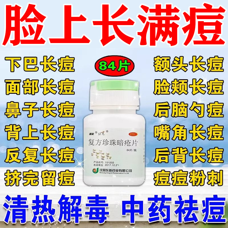 祛痘清热解毒片祛痘内调口服中药清痘玫瑰痤疮复方珍珠暗疮片