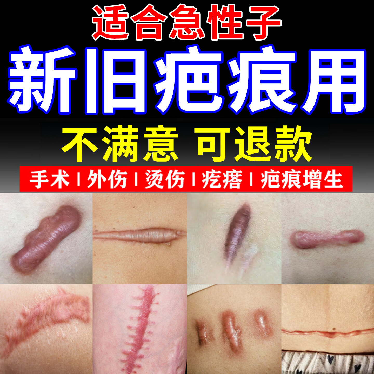 诗梦娜丽莎祛疤凝胶祛疤痕膏增生凸起去除疙瘩瘢痕剖腹产疤痕修复