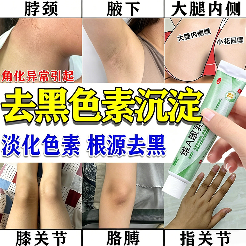 维a酸乳膏医用官方旗舰店祛痘印修复淡化痘印去黑色素沉淀