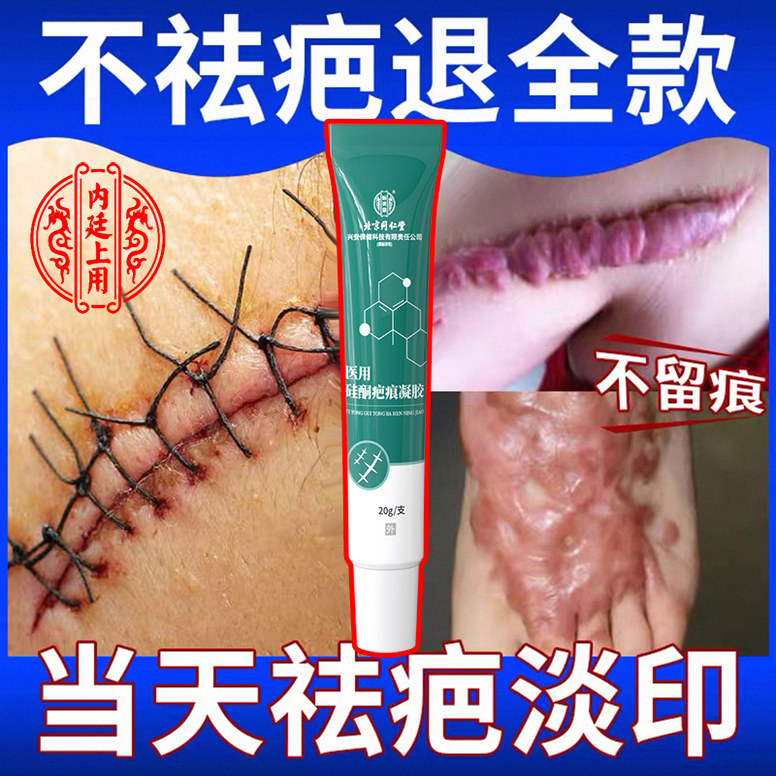 祛疤痕除疤第一名医用硅酮凝胶