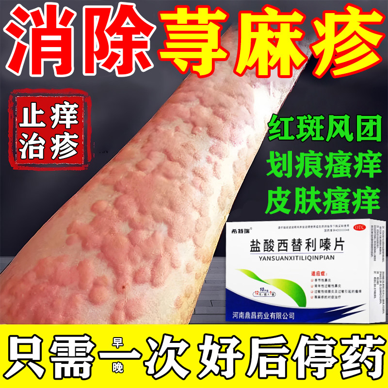 寻荨麻疹过敏止痒断专根用药治疗荨麻疹的特新效药盐酸西替利嗪片