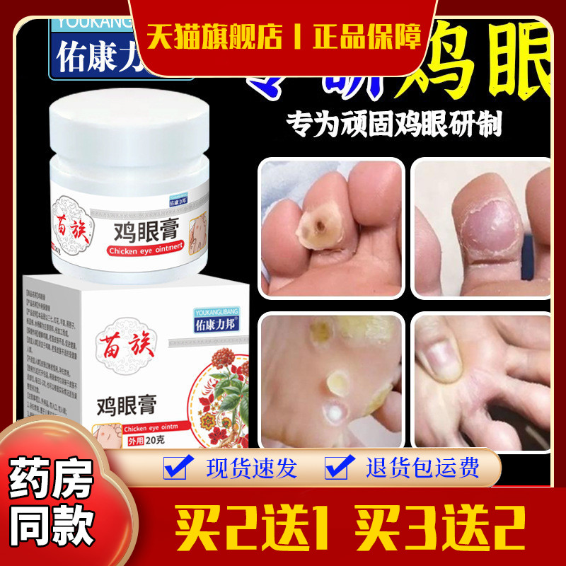 佑康力邦鸡眼膏老茧脚茧斯皮茧灵鸡眼膏足部护理脚底死皮工厂直营