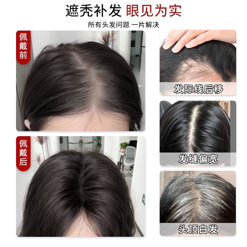 假发女片头全真发蓬松增发量遮头顶稀少神器高颅顶八字刘海假发片
