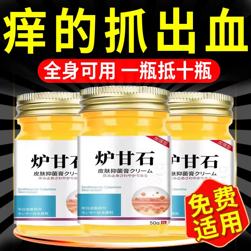 日本炉甘石洗剂皮肤痒瘙外用软膏全身皮肤手脚干痒真菌痒止膏杀菌