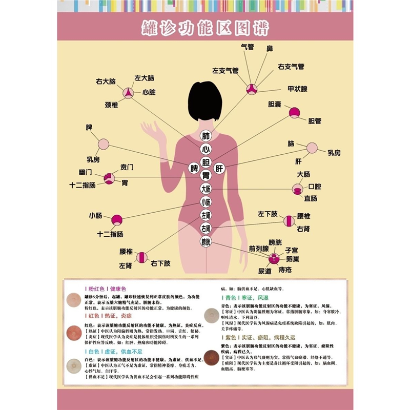 中医经络罐诊功能区图谱挂画罐诊软装墙贴