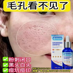 香港大药房正品收缩毛孔粗大痘印坑修复闭口角质透明质酸钠精华液