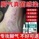 脚气喷雾止脱皮痒杀菌去真菌感染专用除臭脚出汗糜烂脚丫脚趾缝根