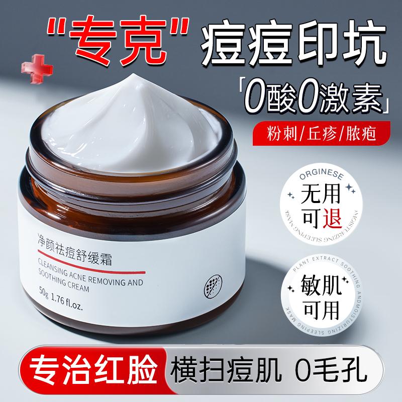祛痘印修复淡化痘印面霜