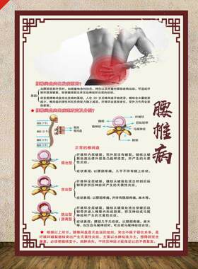 颈椎图片膝关节炎宣传画骨质增生挂画脊柱图腰椎病症图肩周炎海报