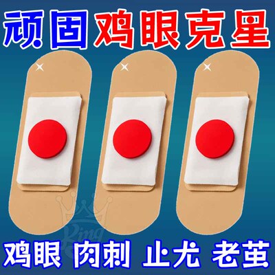 鸡眼贴鸡眼膏脚底脚趾手足老茧肉刺跖疣脚丁瘊子脚垫刺窝鸡正品