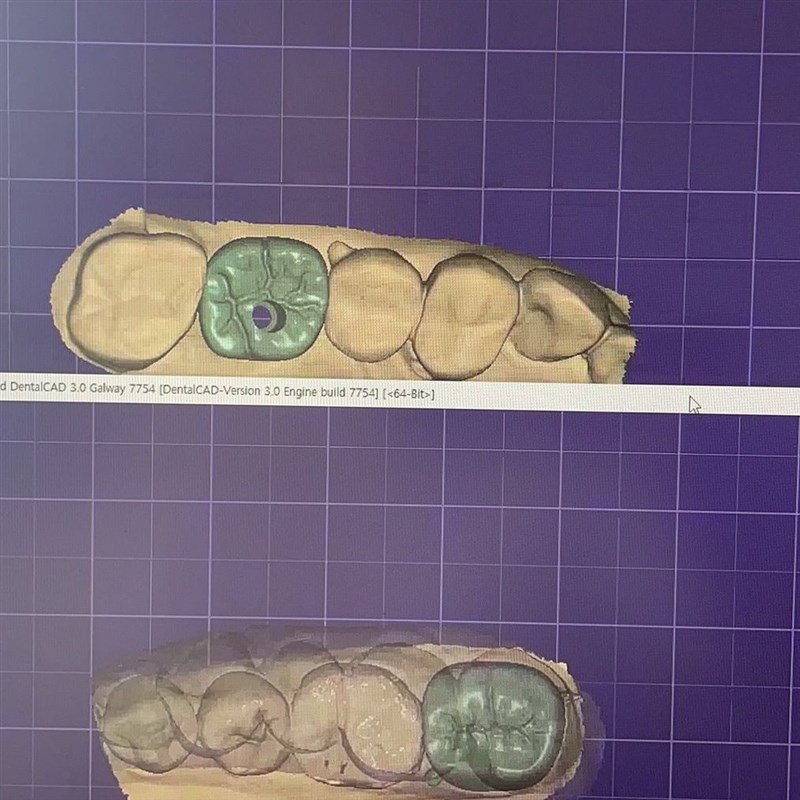 设计软件.本全模块数据库修复加密狗安装牙型