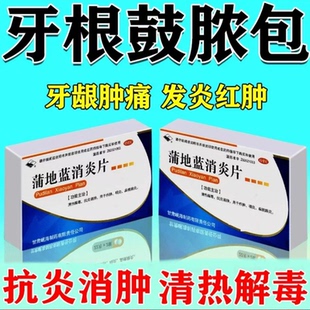 牙龈肿痛消炎药 牙根鼓包长脓包流脓 牙龈肿胀鼓包吃的药牙龈消炎