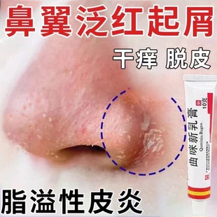 脂溢性皮炎脸干起皮药膏泛红有碎眉鼻子两侧嘴巴周围发红发痒