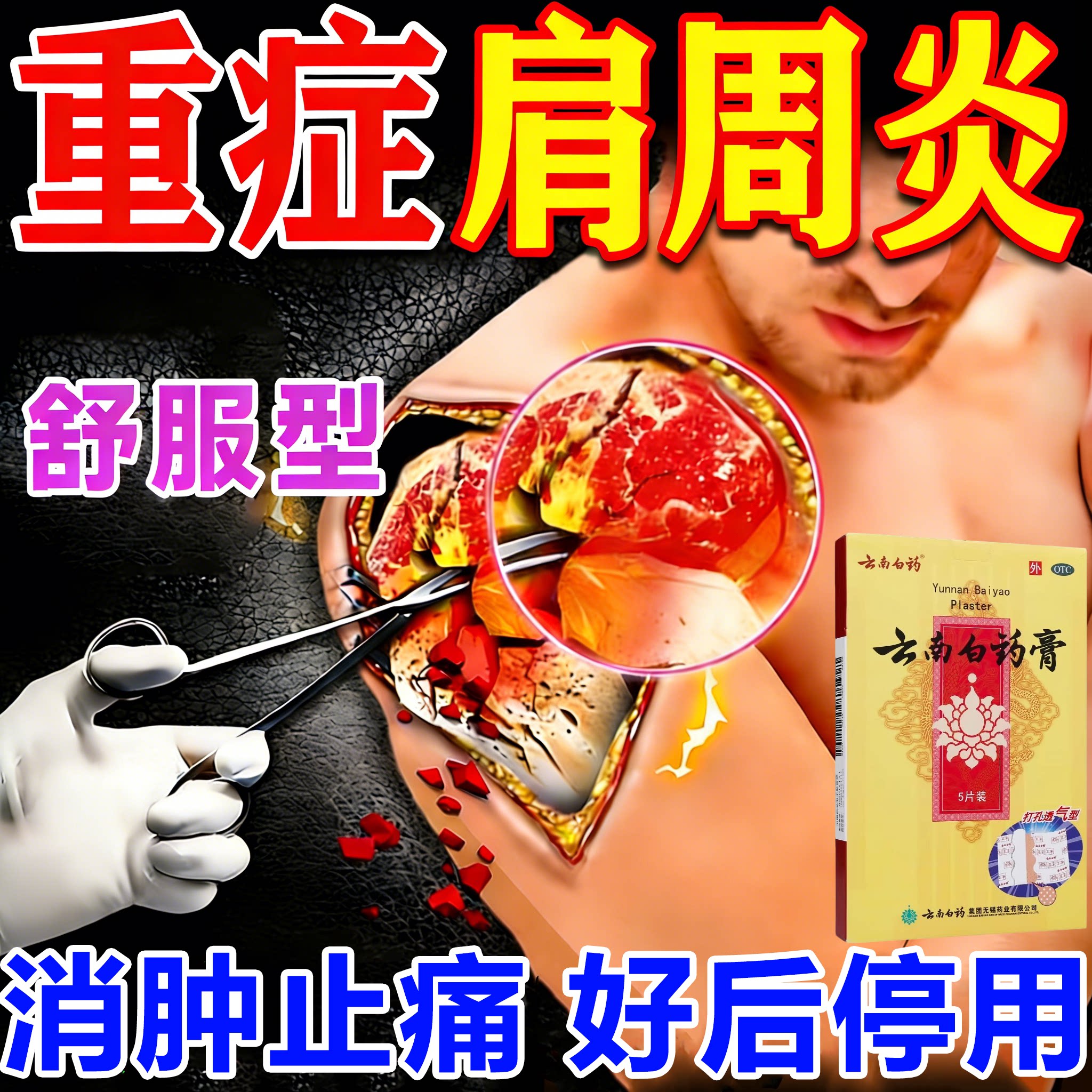 云南白药膏肩周贴 肩周炎专用贴膏活血散瘀消肿止痛肿痛镇痛