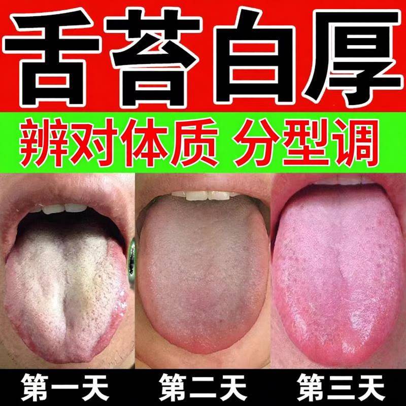 健脾祛湿调理脾胃去体内湿气热寒湿养生茶茯苓养胃除湿疏肝去湿气