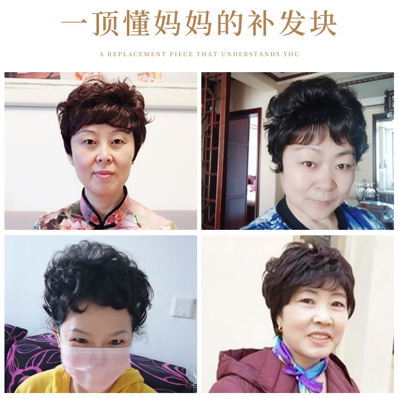 头顶补发片女中老年妈妈假发片真发丝遮白发增发量一片式无痕发块