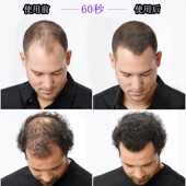 密丰增发纤维假发补充包袋装 男女快补发密发美发掉头发多浓发70g