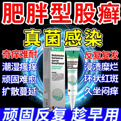 【肥胖型股癣真菌感染】官方正品