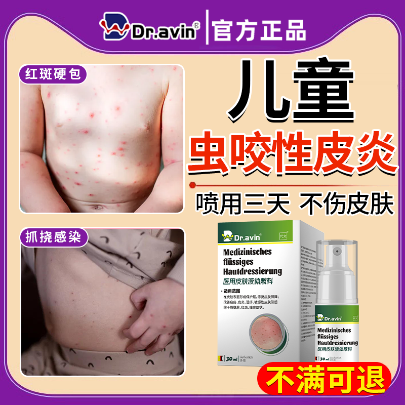 儿童蚊叮螨虫咬性皮炎丘疹荨麻疹过敏瘙止痒快消肿特膏药贴效速LB