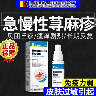 急慢性寻荨麻疹提高免疫力皮肤过敏止痒膏断香皂根丘疹药监备案CS