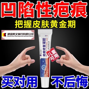 Dravin去除凹陷性疤痕修复除疤膏凹陷人搭表皮生长因子凝胶儿童LJ