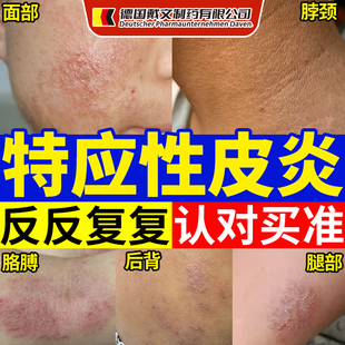 Dr.avin德国戴文儿童特应性特异性皮炎止痒去身体乳根软膏药膏LJ