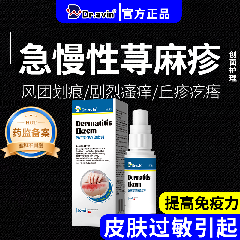 急慢性寻荨麻疹提高免疫力皮肤过敏止痒膏断香皂根丘疹药监备案CS