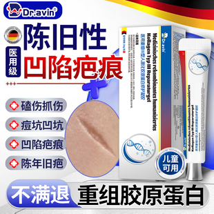 陈旧性凹陷性疤痕修复生长因子除疤膏指甲抓伤去疤膏儿童祛疤膏QQ