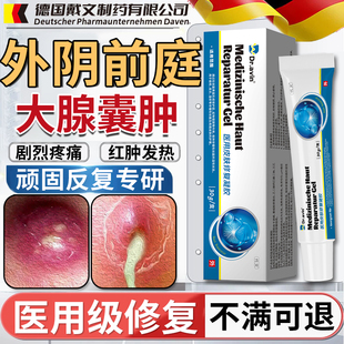 Dr.avin前庭大腺囊肿巴氏腺囊肿疏通外阴有疙瘩肿痛痘痘火疖子SE