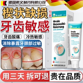 牙根牙釉质腐蚀牙齿烂洞修复液楔状缺损修补敏感修护凝胶非牙膏CS
