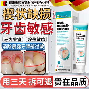 牙根牙釉质腐蚀牙齿烂洞修复液楔状缺损修补敏感修护凝胶非牙膏CS