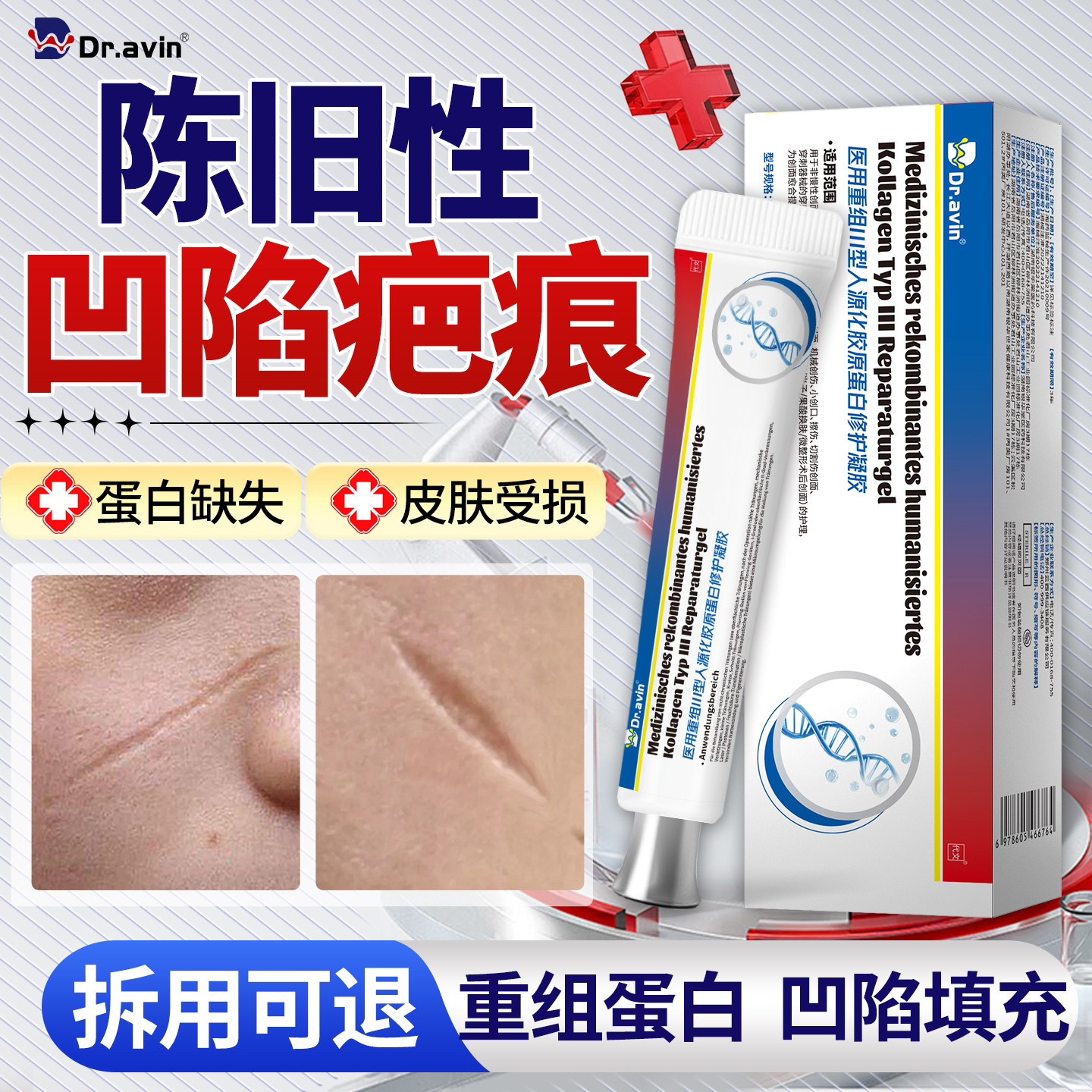 Dr.avin医用重组三型人源化胶原蛋白凹陷性疤痕修复生长因子QQ