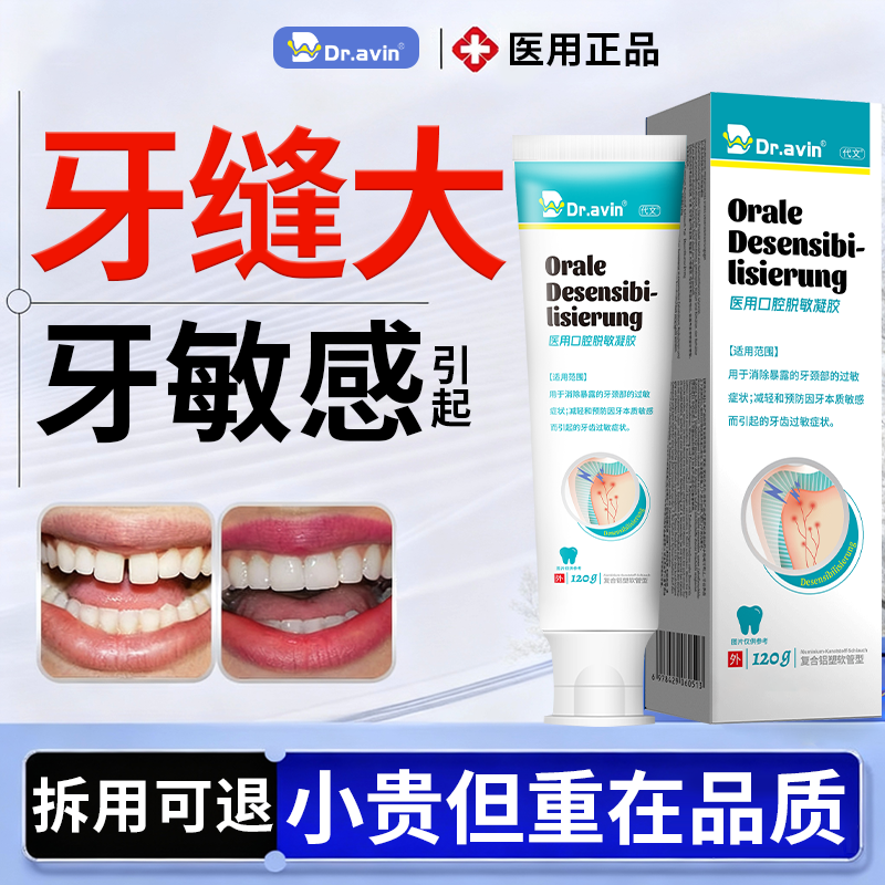 Dr.avin牙齿缝隙填牙缝宽大修复补门牙缝大牙洞膏牙齿敏感自己HY