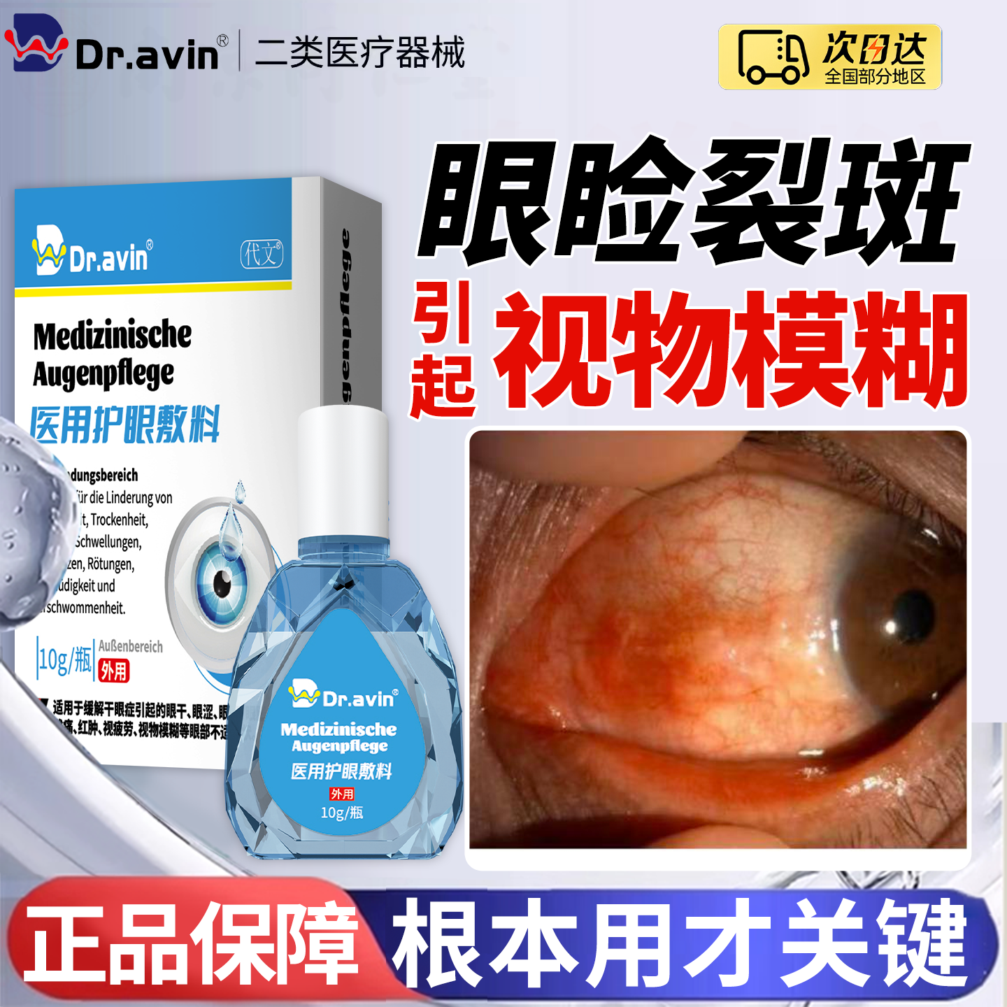 dravin眼睑裂斑眼底黄斑病变眼药水滴眼液眼白发黄眼睛清澈去黄LJ