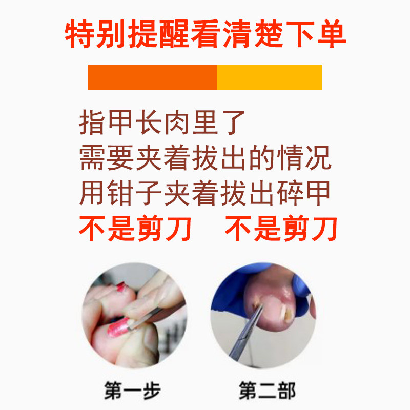 不锈钢拔嵌甲钳夹指甲镊子尖细个人修脚工具清洁护理甲沟拔火罐炎,家庭/个人清洁工具,指甲钳,淘宝优惠券,粉丝福利购,淘宝优惠卷