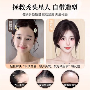 闪格假发女片头顶【隐形纱】夏季薄款蓬松高颅顶遮白发真发浏海片