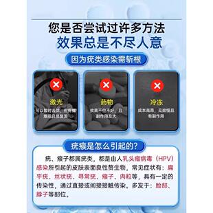 花祛疣软膏灵凝胶NAP去疣扁平疣去葵除膏疣瘊小肉粒膏非一抹神灵