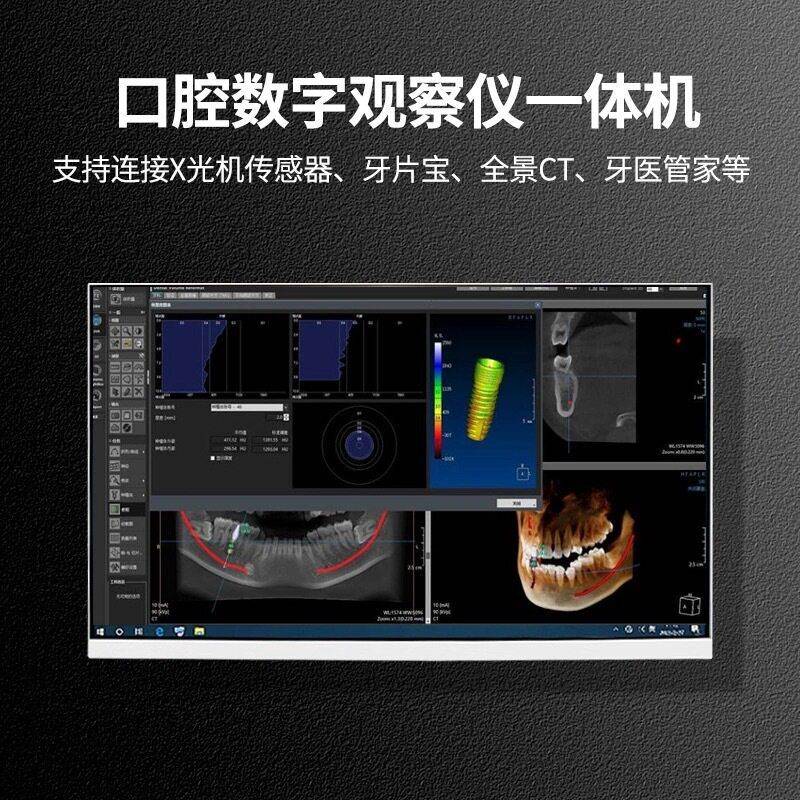 牙科内窥镜电脑一体机口腔观察仪牙齿清拍照设备小推车带插座