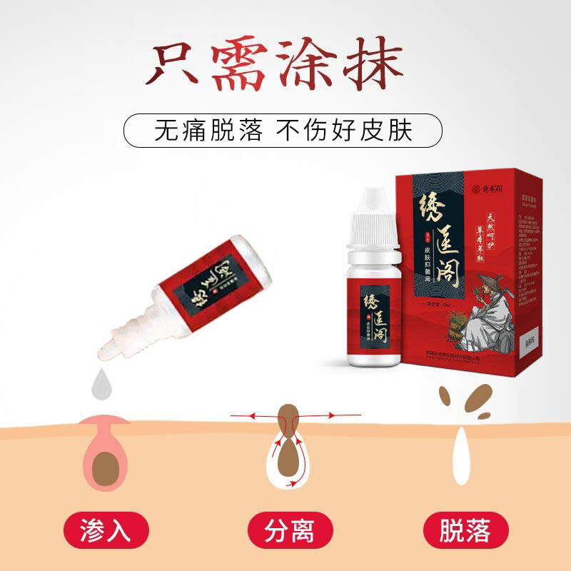 去脚底厚硬老茧脚垫除手足部趾头上关节茧老茧死皮鸡茧软化剂神器