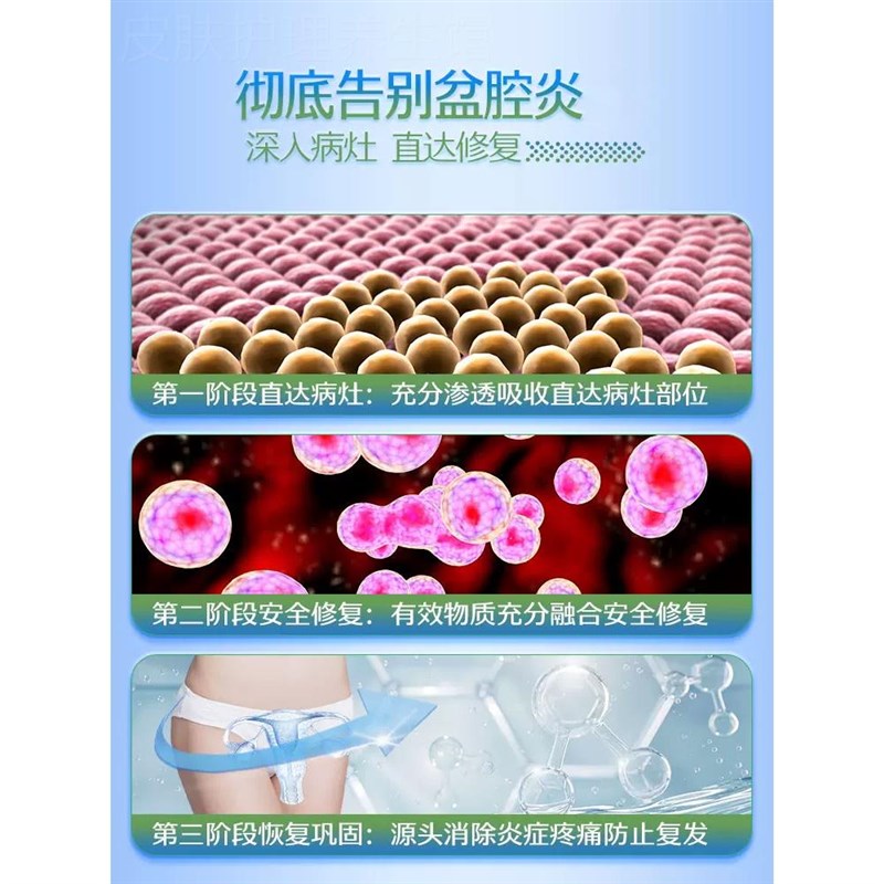 盆腔积液宫腔积水疏不通卵输管热敷包通疏通贴而不畅黏连堵塞神器