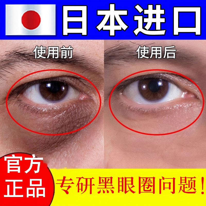 日本黑眼圈去除神器正品