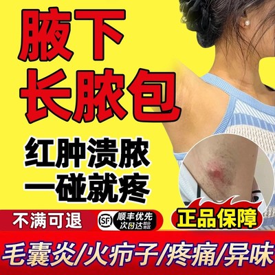 腋下长脓包膏头皮马拉色菌