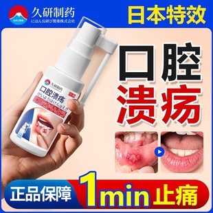日本口腔溃疡一点灵喷剂扁平苔藓治疗凝胶修复维生素黏膜专用正品