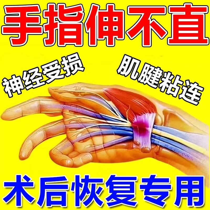肌腱粘连膏药手指伸不直关节膝盖僵硬损伤恢复骨裂康复贴折药正品