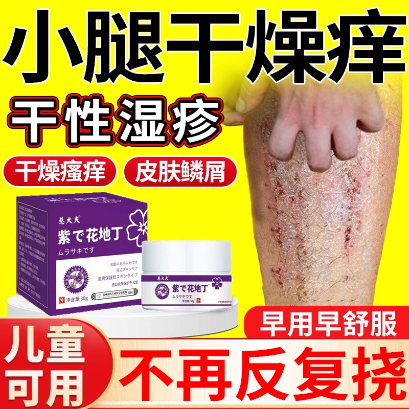 皮肤干燥瘙痒止痒膏抑菌膏补水