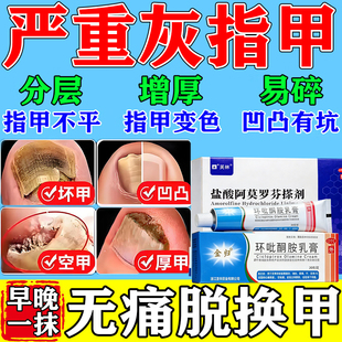环吡酮擦搽剂官方正品亮甲灰指甲专用药真菌感染坏甲环比酮胺乳膏
