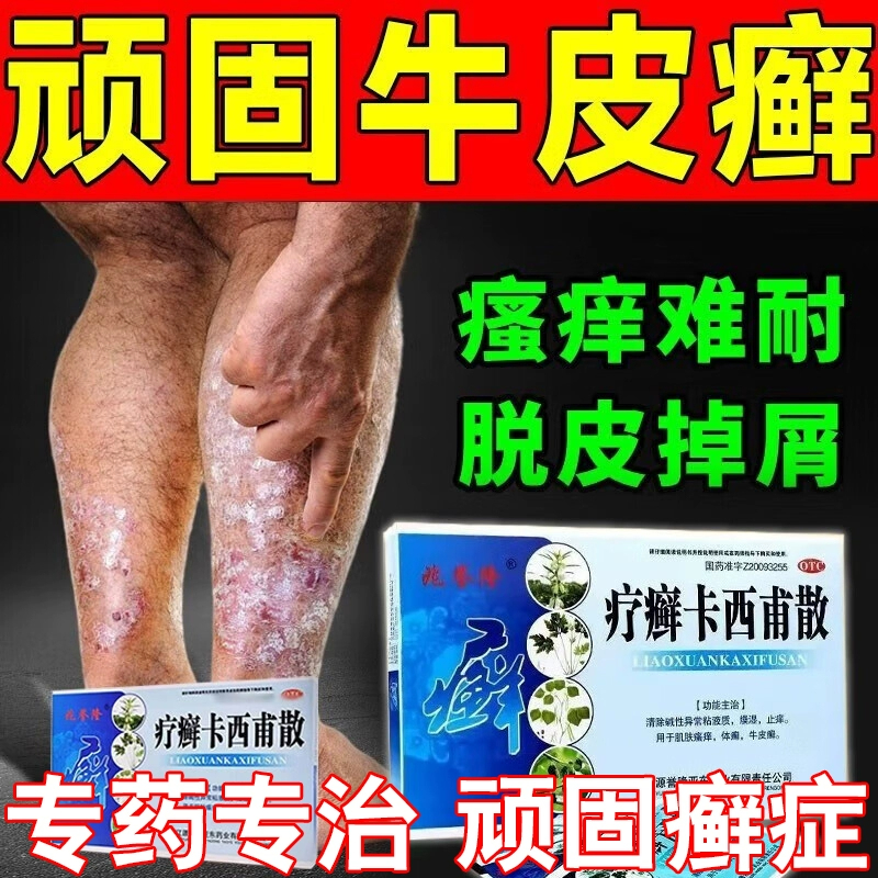 【兆誉隆】疗癣卡西甫散10g*4袋/盒